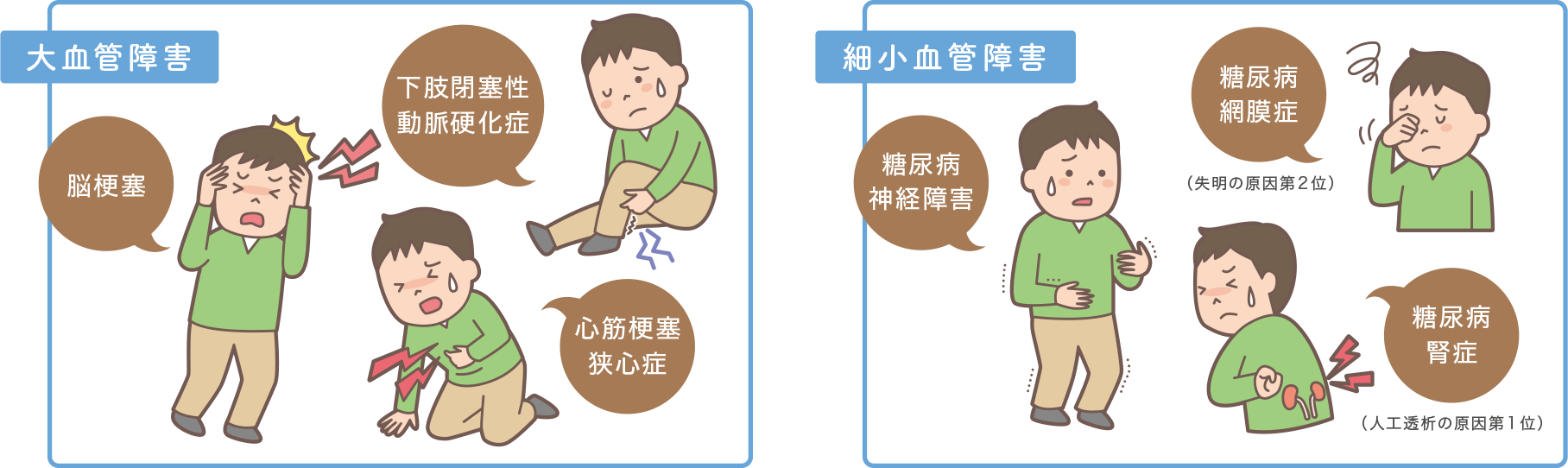 大血管障害:脳梗塞、下肢閉塞性動脈硬化症、心筋梗塞狭心症 細小血管障害:糖尿病神経障害、糖尿病網膜症、糖尿病腎症